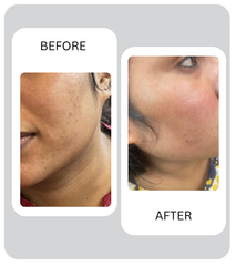 Brighten me UP ( Vitamin C + Glyco Glow + Brightening Monster + Sun scape )