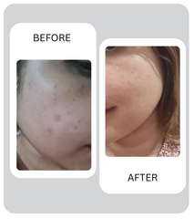 Glow Up Trio: Purenia + C‑Glow + Glyco Glow