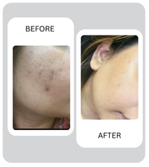 Glyco Glow (Night Cream For Bright, Smooth & Clear Skin)
Cerave